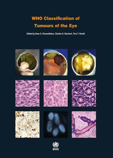 عکس WHO Classification of Tumours of the Eye, 4th Edition2018 طبقه بندی تومورهای چشم